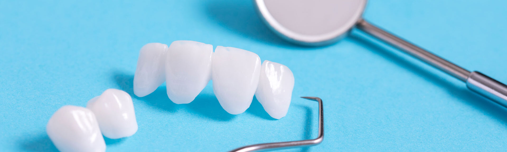 セレック治療について｜比較的短期間での治療を検討されている方へ