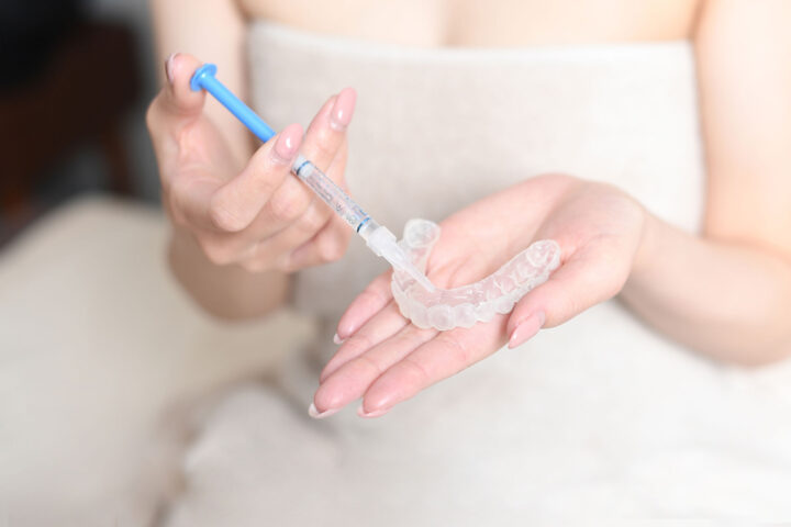 ホワイトニング｜自然な白さを目指すの画像